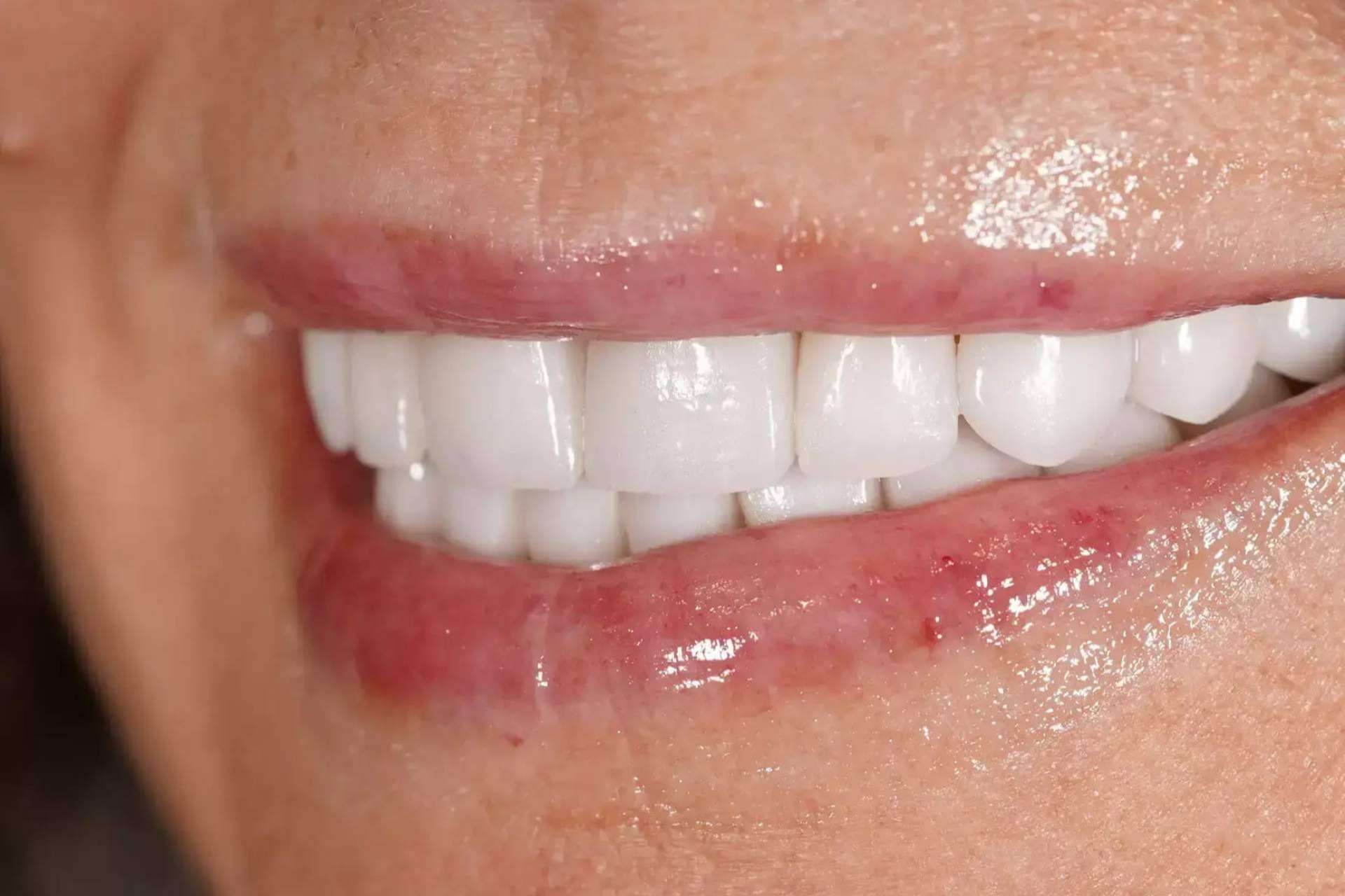 Denty Dent ayuda a mejorar la sonrisa con tratamientos de estética dental