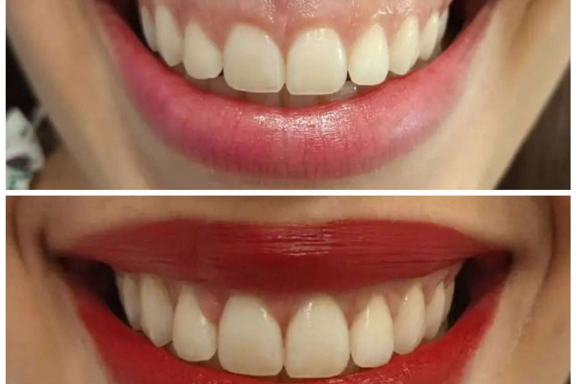 Clínica Calvo de Mora ofrece medicina estética facial y dental para una sonrisa perfecta