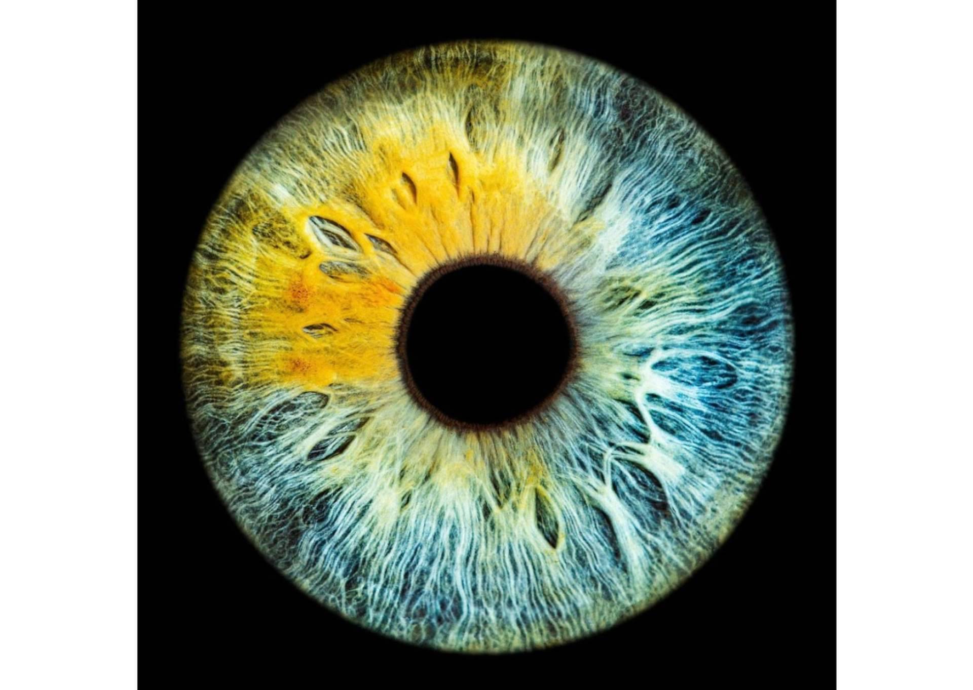 El color de los ojos puede cambiar por enfermedades metabólicas, según una advertencia de la clínica Eyecos