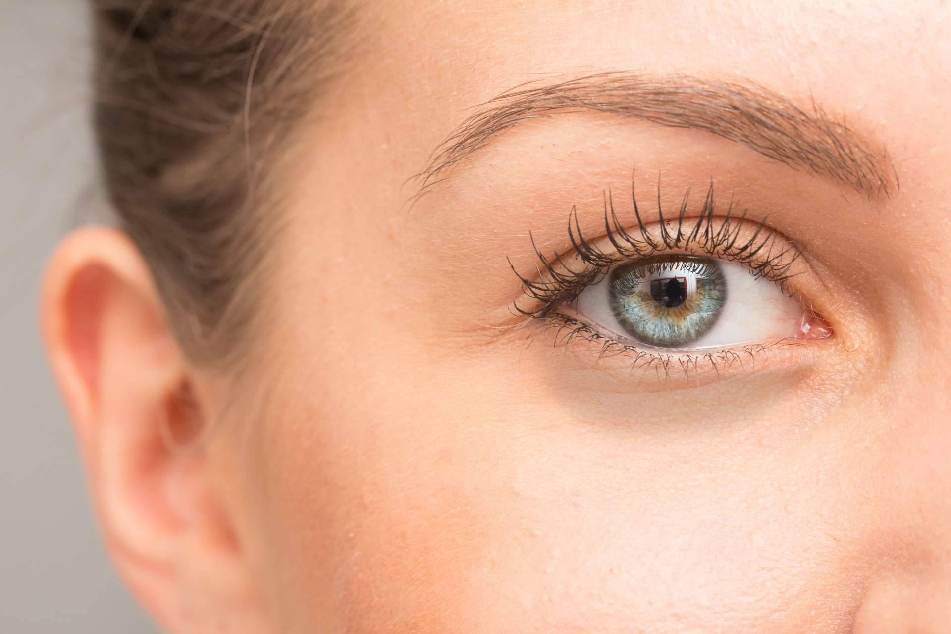 El tratamiento de ojeras con ácido hialurónico que lleva a cabo Alluring Clinic