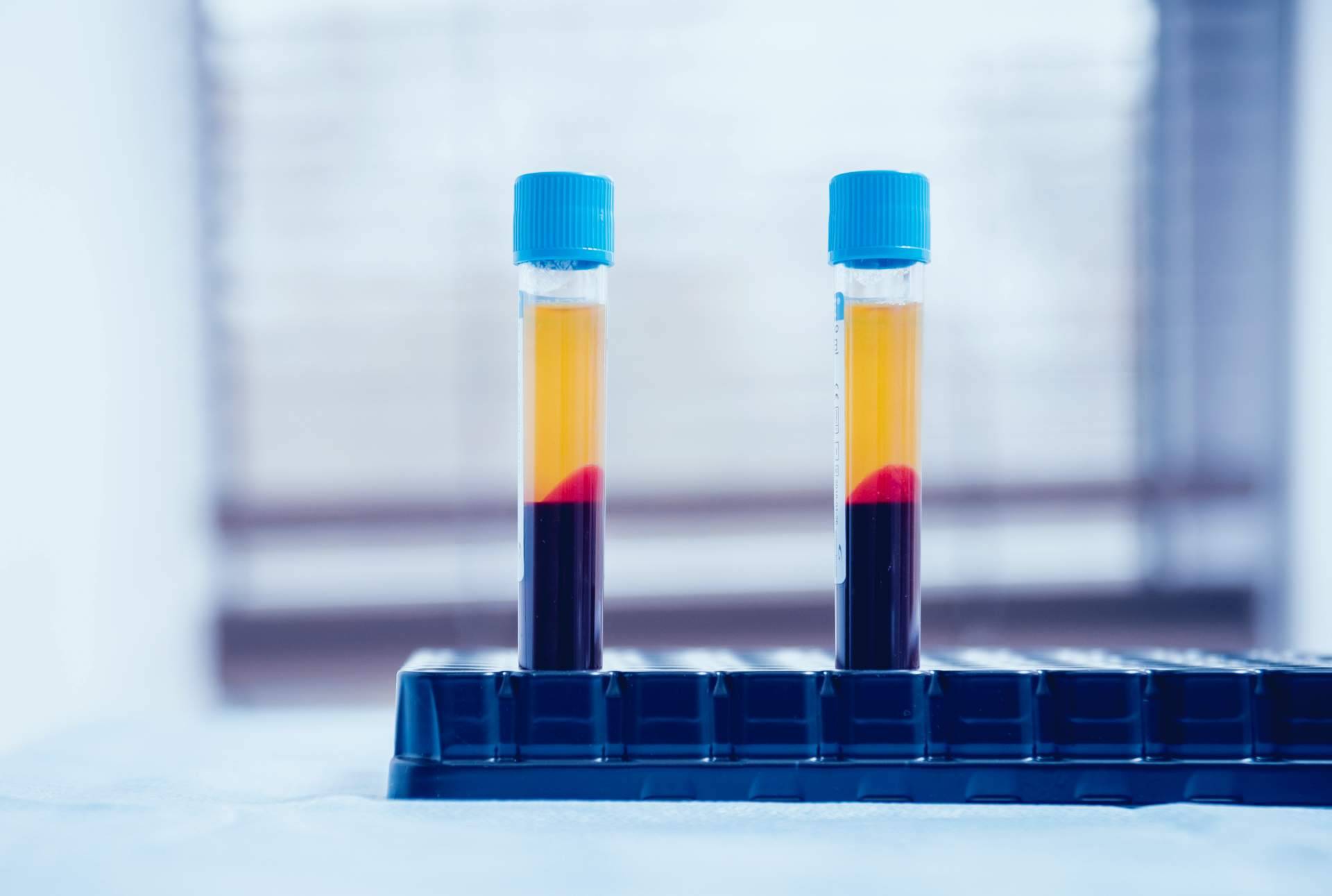 Traumatología, todo sobre el papel del plasma rico en plaquetas