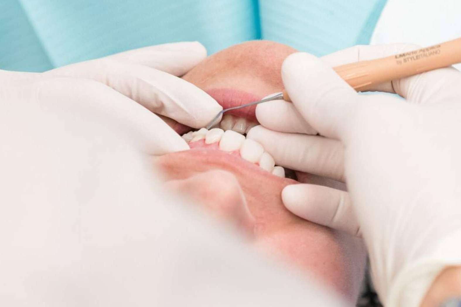 ¿Por qué es importante la prevención y el tratamiento de las enfermedades periodontales?