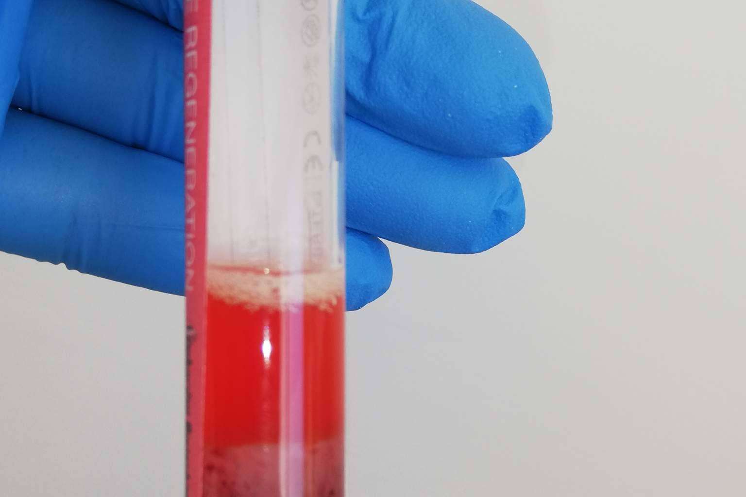 Acceder a terapias con células madre en la Clínica Biorigenera