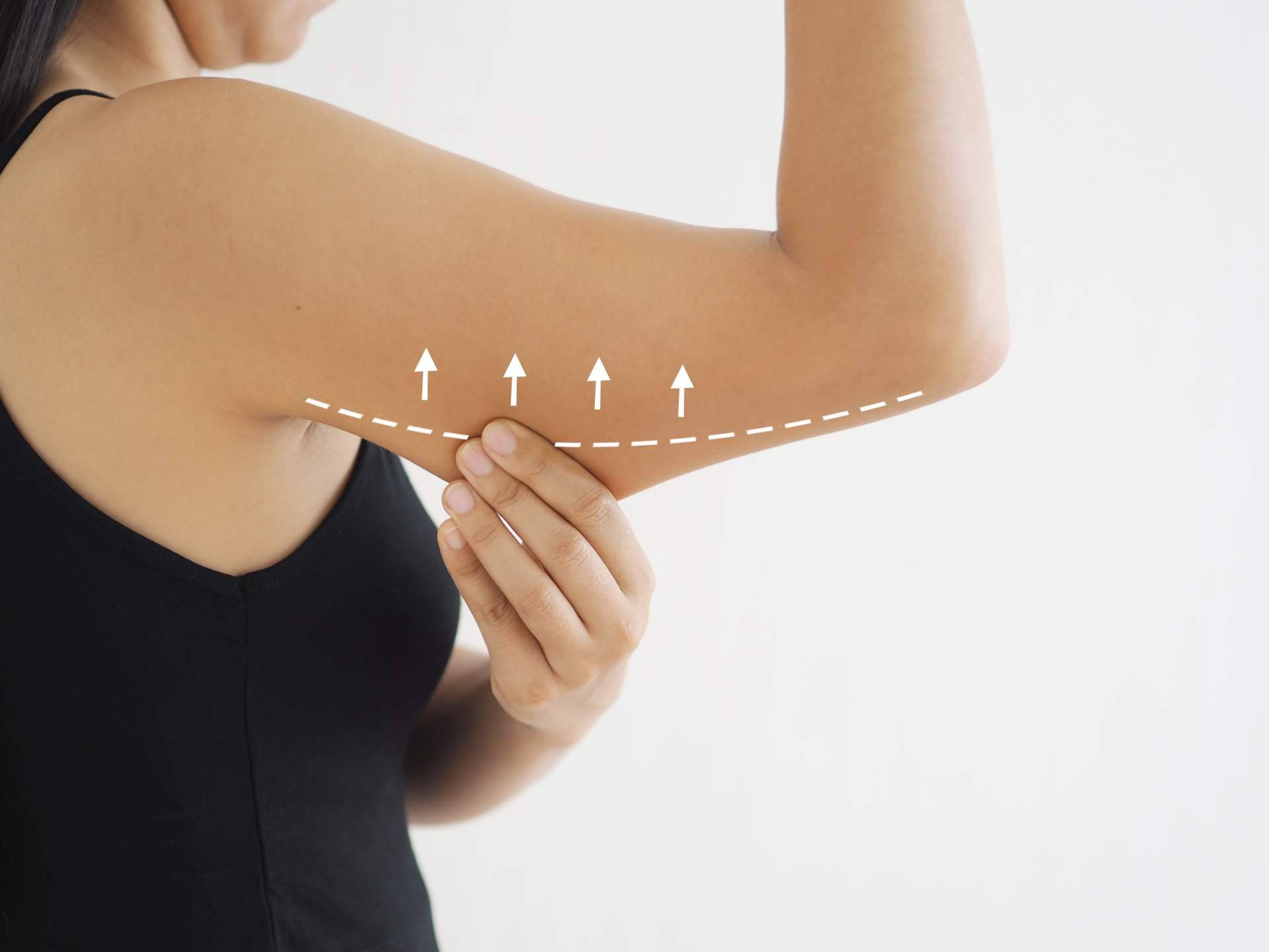 Cuerpo Libre y sus tratamientos anticelulíticos saludables