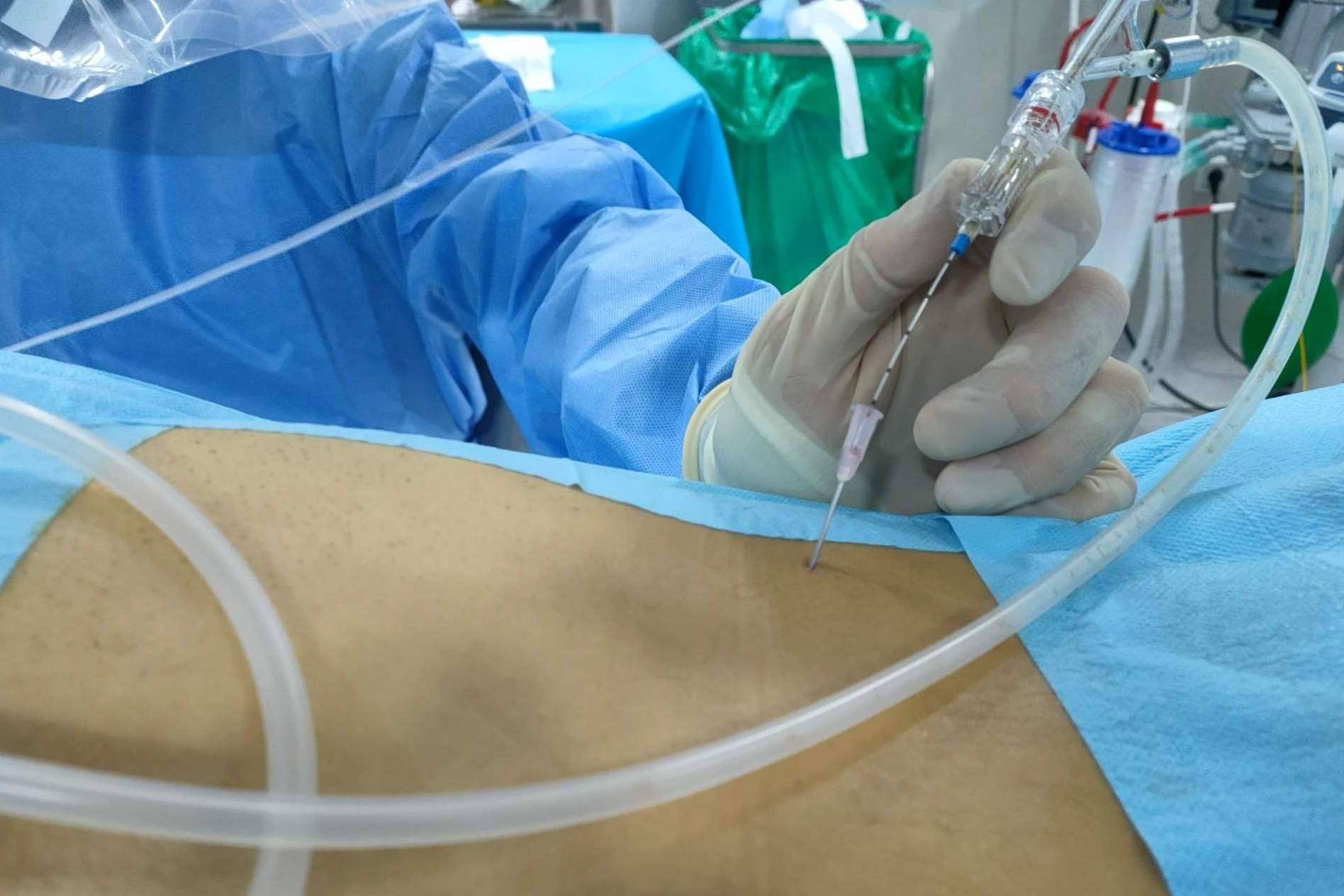 El 82% los pacientes con hernia discal responden al tratamiento láser, en una sola sesión