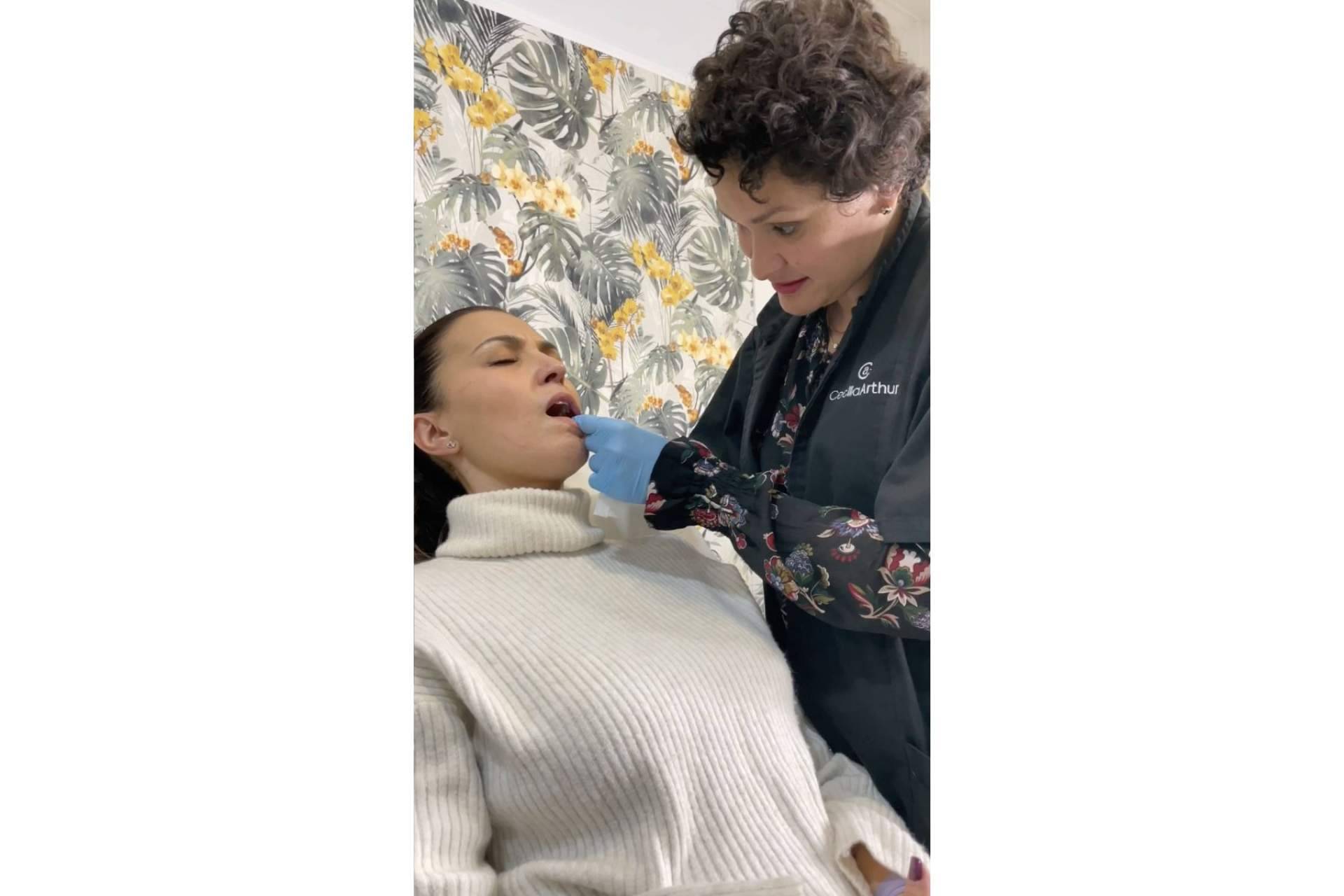 Tratamientos faciales para un rostro perfecto; aumento de labios de la mano de Cecilia Arthur