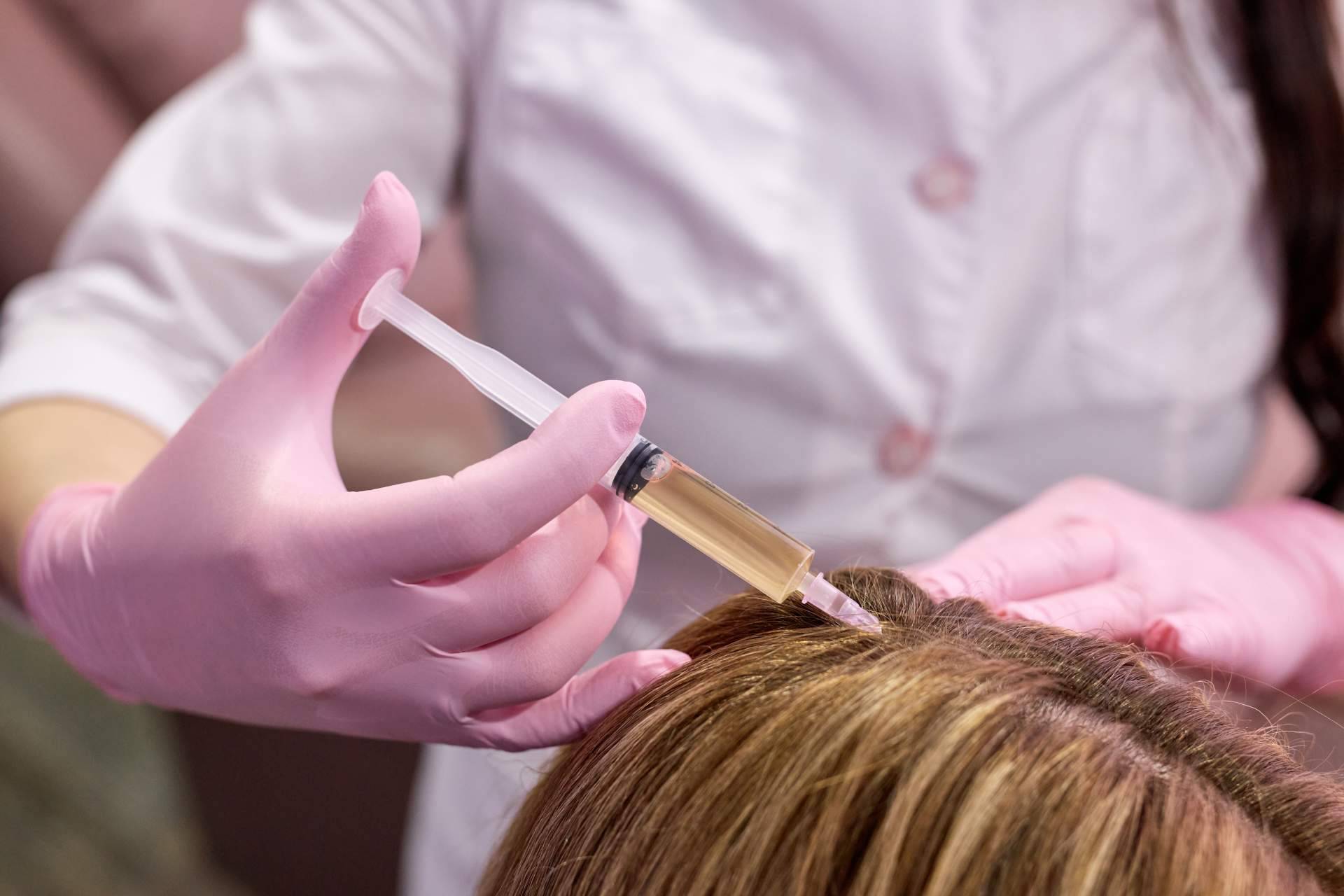 Cómo combatir la alopecia femenina con los tratamientos del Doctor Jesús Aníbal Mora