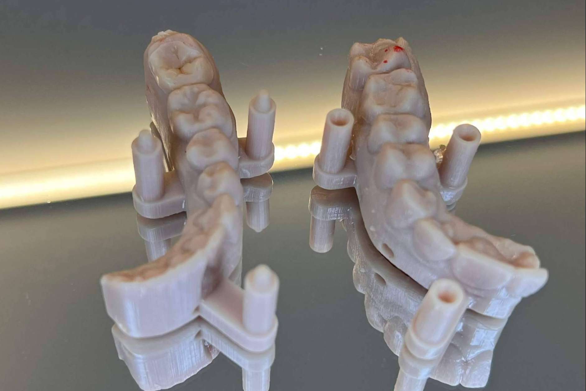 Dentinova aplica tecnología avanzada 3D para recuperar la sonrisa