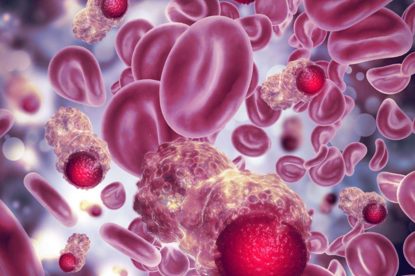 Tratamientos personalizados e innovadores de inmunoterapia para tratar el cáncer