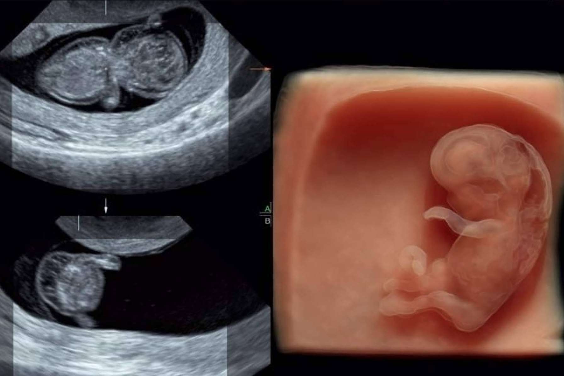 SCPmedical amplía su catálogo con su variedad de ecógrafos accesibles y soporte técnico especializado