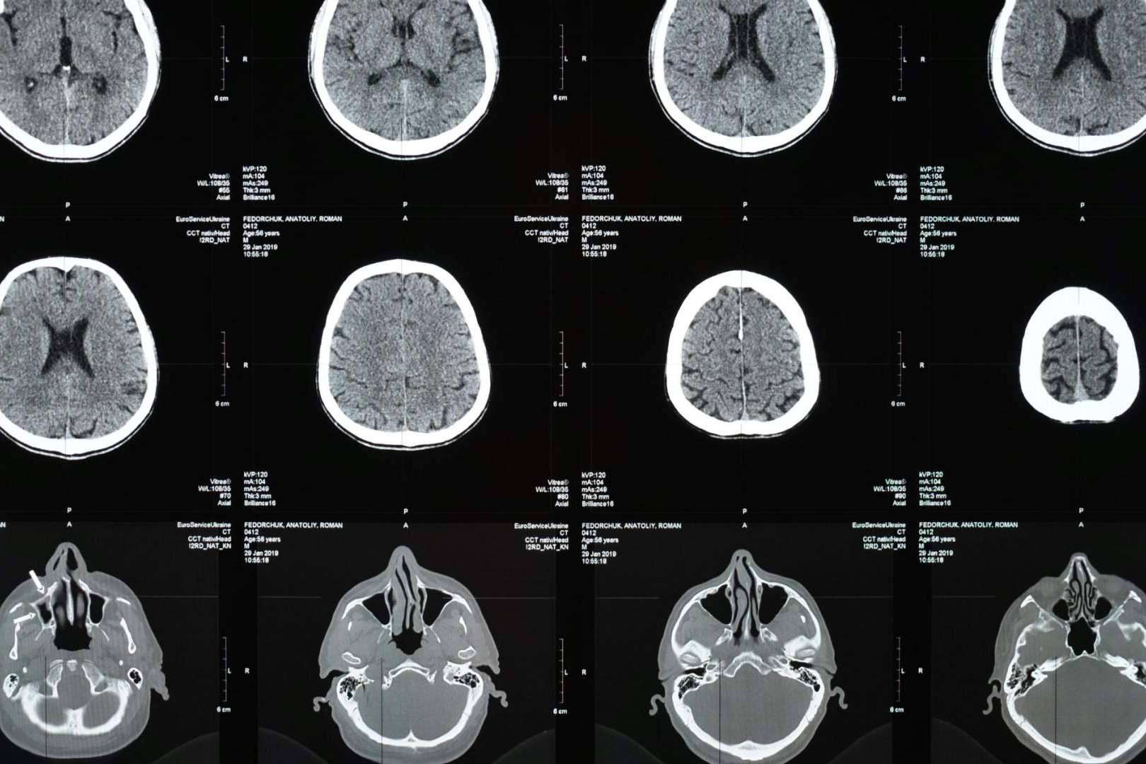 Claudia Lorena Martínez Higueros; una excelencia médica en radiodiagnóstico e intervencionismo vascular