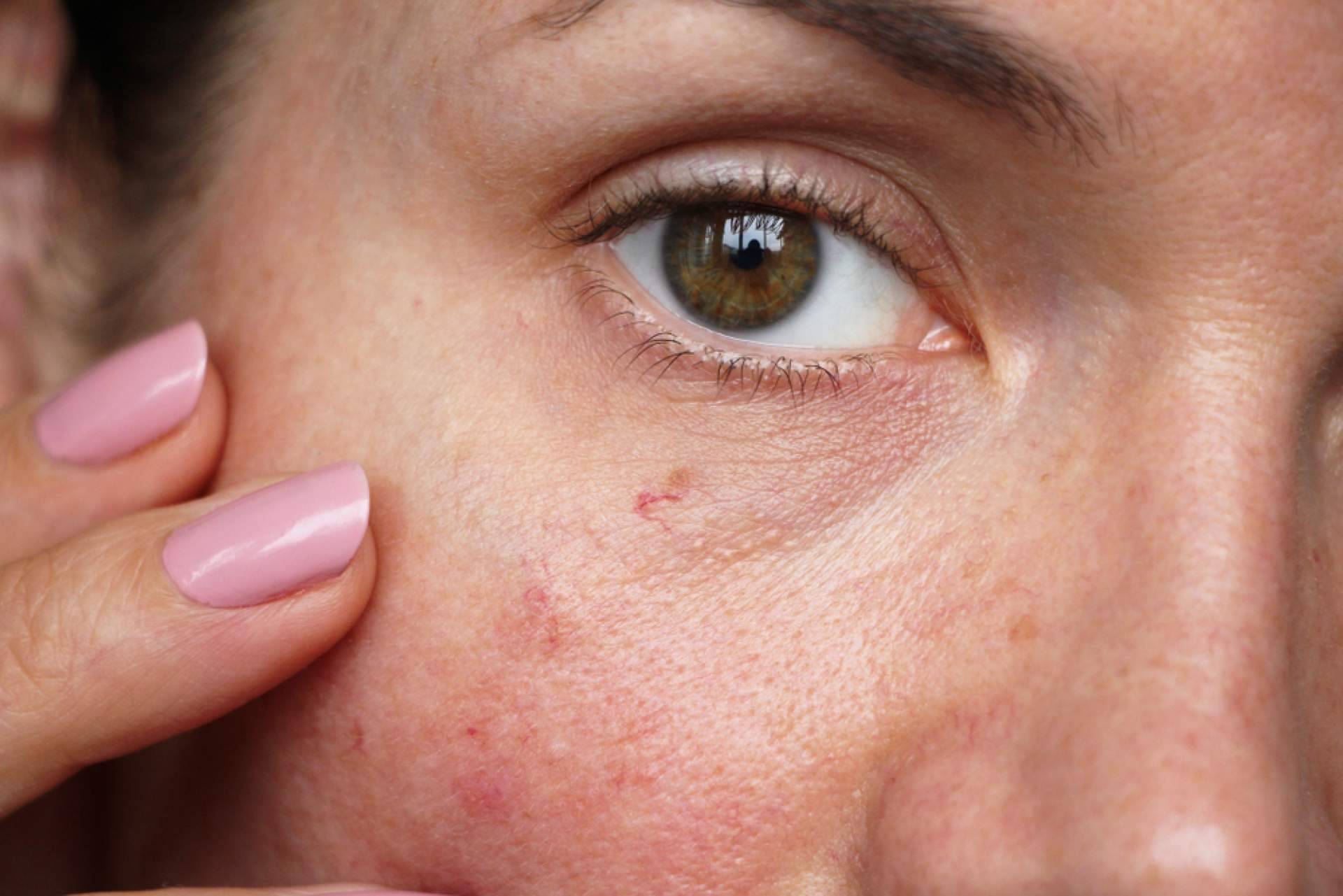 Evoderm, dermocosmética eficaz con ingredientes limpios y aval profesional