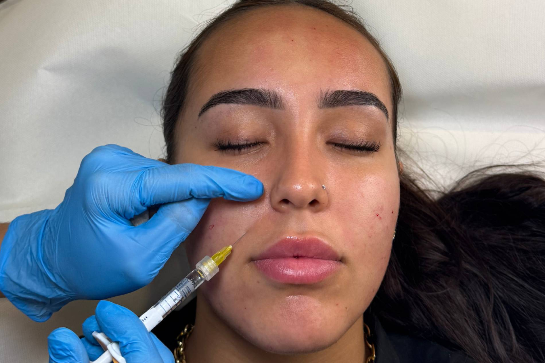 Skinbooster, el aliado invisible para una piel hidratada, firme y saludable
