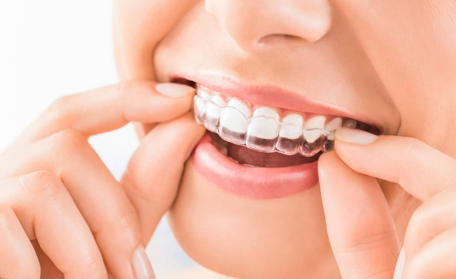 Instituto Dental Oris, Clínica Dental en Zafra de referencia por su especialización en ortodoncia e implantología avanzada