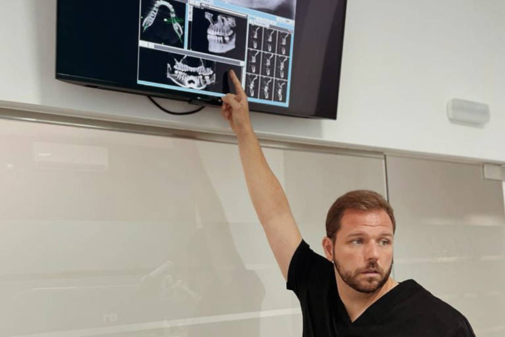 BR Immediate Smile, el protocolo de implantes dentales de carga inmediata de BR Dental Móstoles